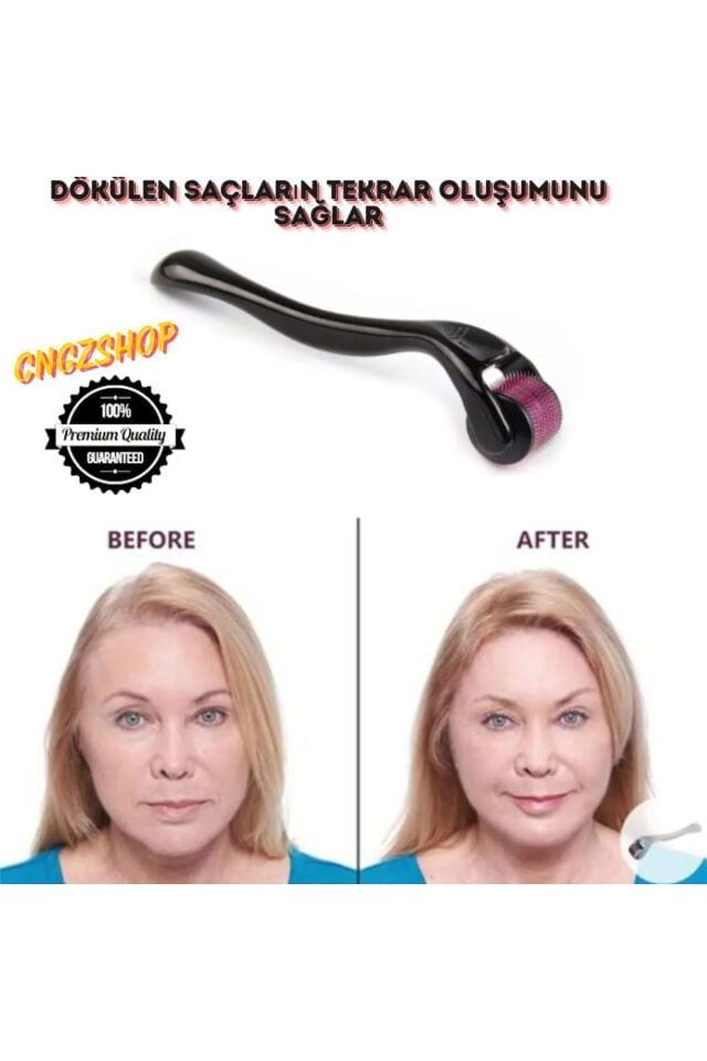 Dermaroller Köseler Ve Dökülen Saçları Için Saç Sakal Çıkartıcı Gürleştirici Titanyum Iğneli 1 Mm