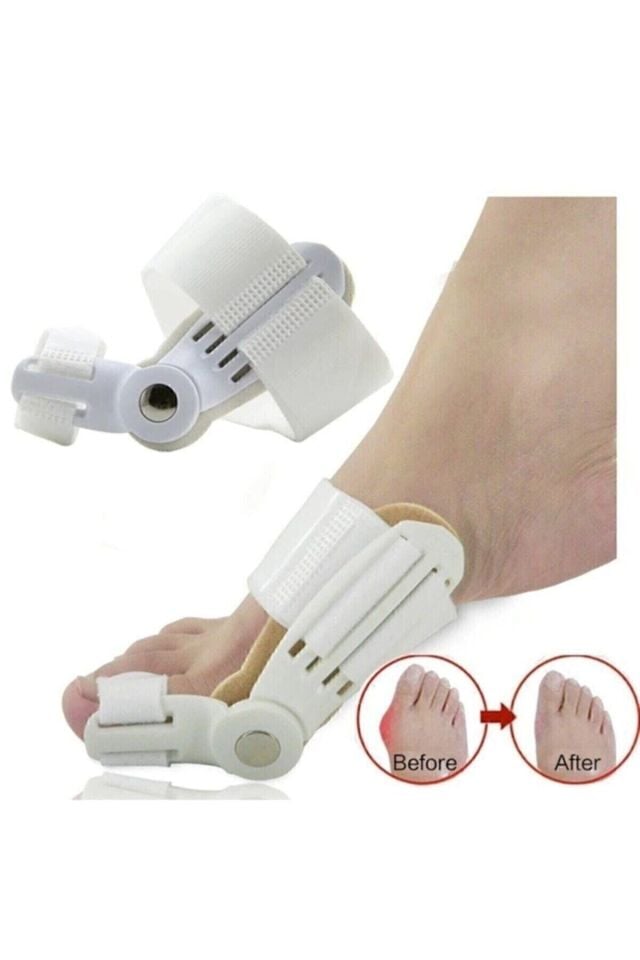 1 Adet Baş Parmak Eğriliği Aparat Kemik Bunyon Gece Ateli Halluk Valgus