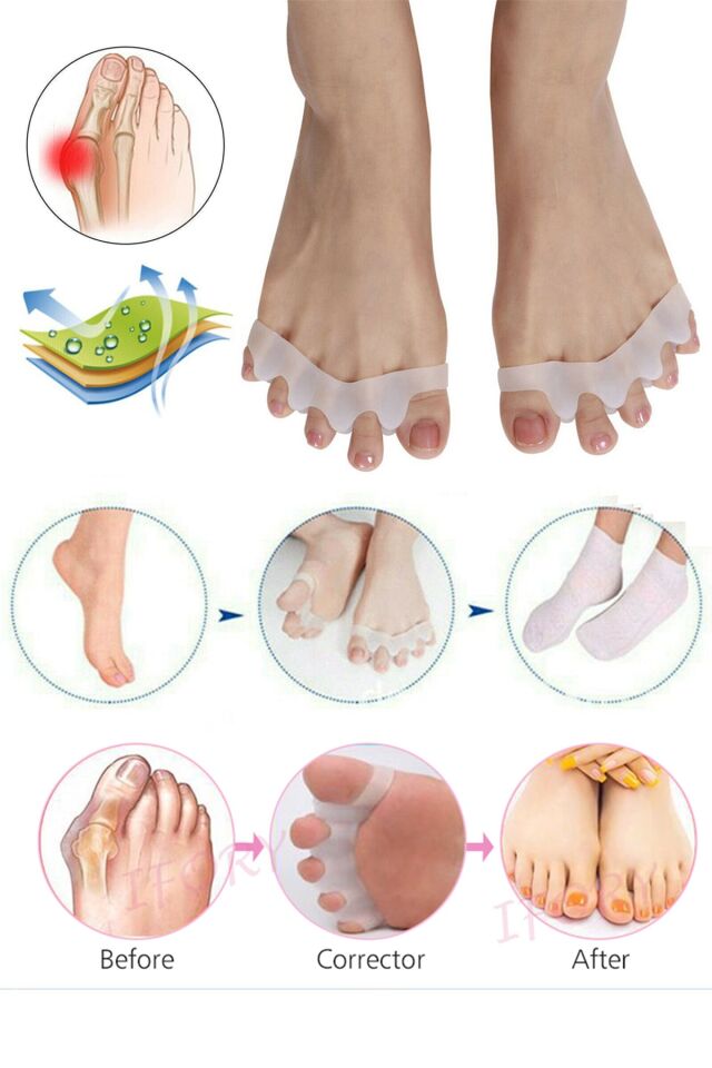 Makara Ayak 5 Parmak Ayıran Silikon Bunyon Koruyucu Parmak Ayırıcı Gece Ateli Halluks Valgus